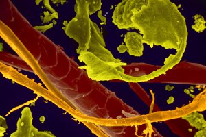 Перхоть и волосы