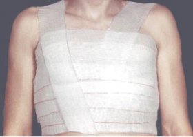 Чёт не видно прыгающих по асфальту грудей - у встречной водилы тоже оторвало, оказывается !