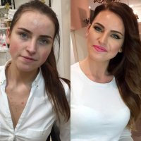 Вот тут девушка ДО выглядит красивше. Да и вообще сама по себе красавица.